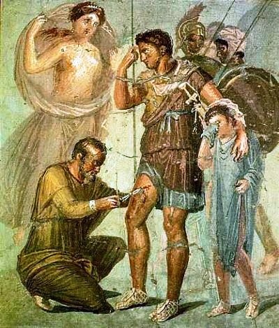 Cirurgià militar netejant la ferida d'un soldat. Fresc de Pompeia.